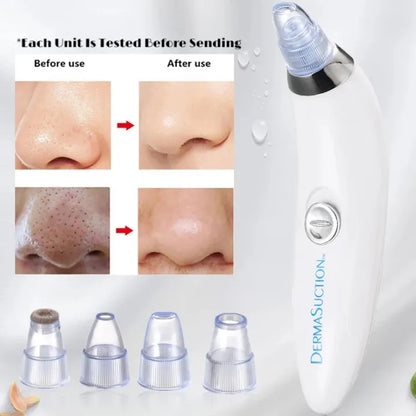 Deal Zone | Derma Suction Facial SPA Blackhead Remover Machine 4 in 1 – Battery Operated