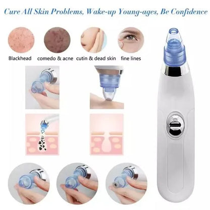 Deal Zone | Derma Suction Facial SPA Blackhead Remover Machine 4 in 1 – Battery Operated